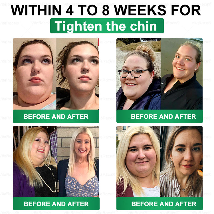 𝐕𝐢𝐭𝐚𝐑𝐚𝐜𝐞® 𝑴𝒆𝒕𝒂𝒃𝒐𝒍𝒊𝒄 𝑵𝒂𝒏𝒐 𝑴𝒊𝒄𝒓𝒐𝒏𝒆𝒆𝒅𝒍𝒆 𝑷𝒂𝒕𝒄𝒉🇨🇦(𝐉𝐮𝐬𝐭 𝐨𝐧𝐜𝐞 𝐚 𝐝𝐚𝐲, 𝐯𝐢𝐬𝐢𝐛𝐥𝐞 𝐜𝐡𝐚𝐧𝐠𝐞𝐬 𝐢𝐧 𝟕 𝐝𝐚𝐲𝐬）𝘽𝙚𝙧𝙗𝙚𝙧𝙞𝙣𝙚 + 𝙈𝙤𝙧𝙞𝙣𝙜𝙖 𝙁𝙤𝙧𝙢𝙪𝙡𝙖 ✅ 𝐅𝐨𝐫 𝐨𝐛𝐞𝐬𝐢𝐭𝐲, 𝗟𝗼𝗼𝘀𝗲 𝘀𝗸𝗶𝗻,𝐝𝐢𝐚𝐛𝐞𝐭𝐞𝐬, 𝐬𝐥𝐞𝐞𝐩 𝐚𝐩𝐧𝐞𝐚, 𝐣𝐨𝐢𝐧𝐭 𝐢𝐬𝐬𝐮𝐞𝐬, 𝐚𝐧𝐝 𝐦𝐨𝐫𝐞 💥